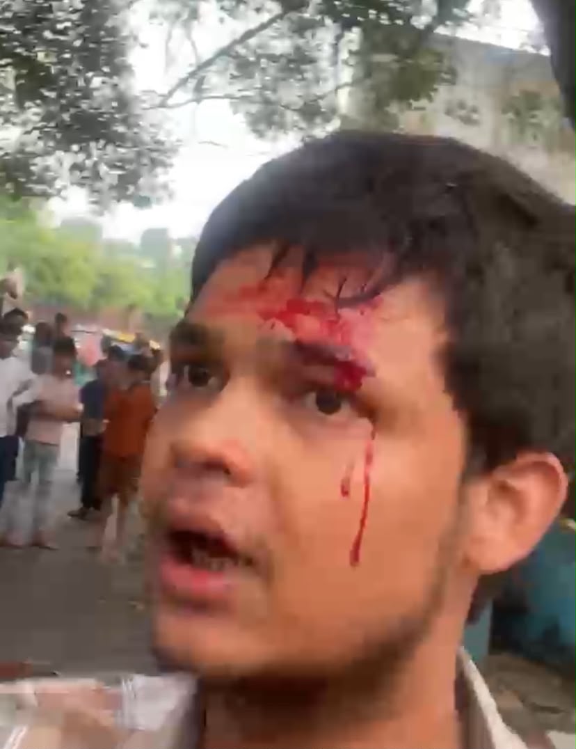 बालूगंज में दबंगों की दबंगई! युवक के सिर पर ईंट से वार, FIR दर्ज